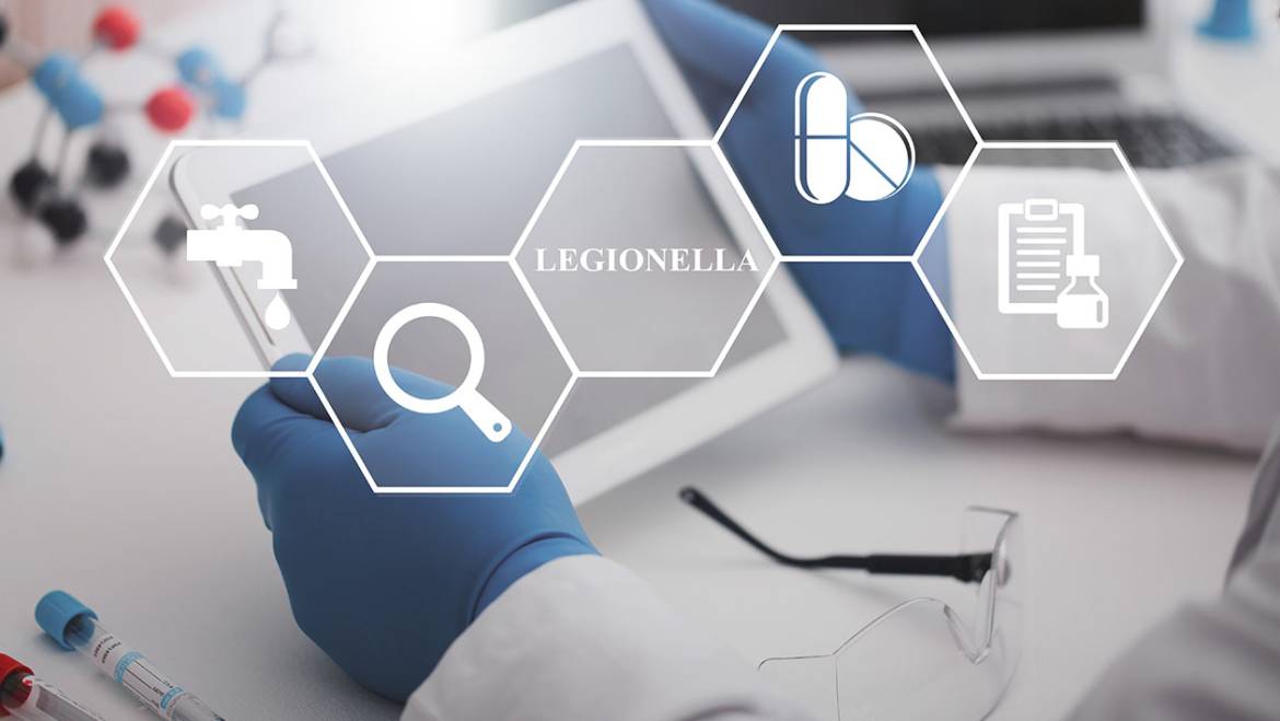 Protege tu salud: Prevención y control de la Legionella y la legionelosis